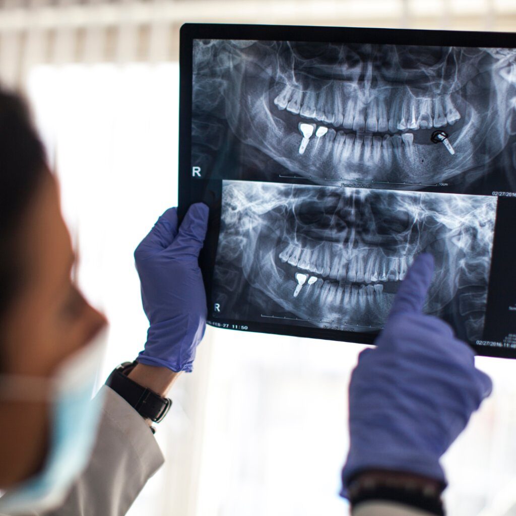 طبيب ينظر إلى صورة إشعاعية للأسنان