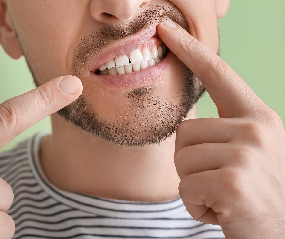 رجل يعاني من حساسية الأسنان