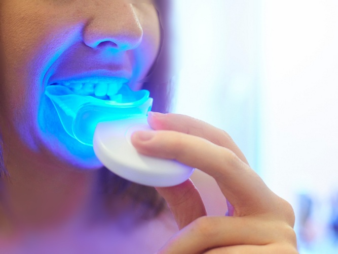جهاز تبييض الاسنان بالليزر المنزلي